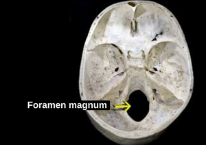 Foramen magnum